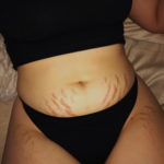 3 inspiring Instagram mums who will make you love your stretch marks, not loathe them