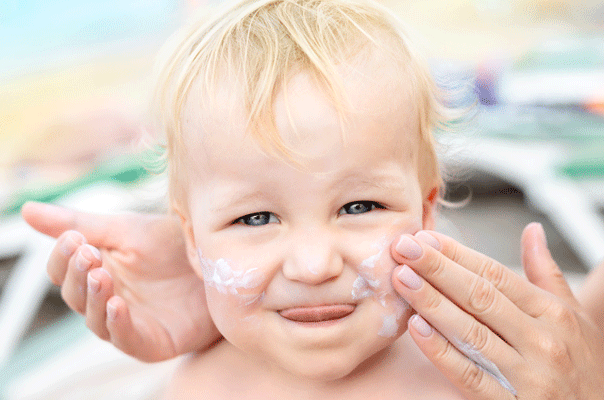 How to treat your child’s sunburn and the sun safety tips to follow