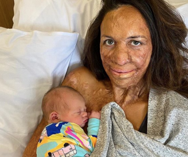 BREAKING: Turia Pitt has welcomed her second baby, and we can’t get enough of his name!