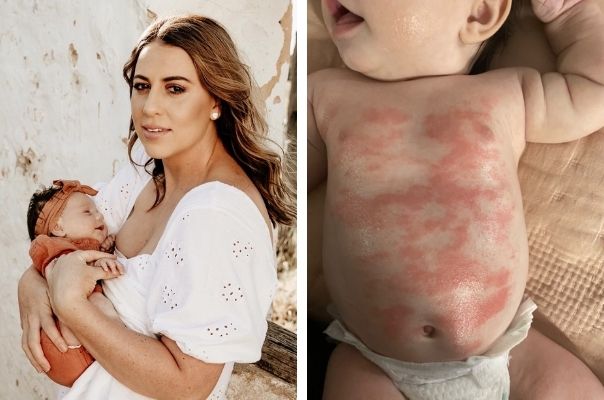 REAL LIFE: “My baby’s skin rash cleared up within 24 hours of using this supermarket moisturiser”