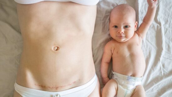 New mother laying next to baby with c-section scar