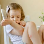 Small girl scratching at mosquito bites while sitting at dining table.