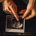 Hands with mini nail polish manicure pointing at ultrasound image