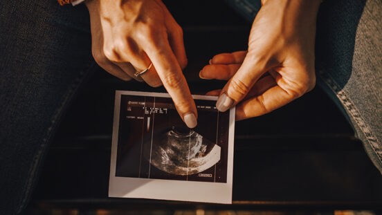 Hands with mini nail polish manicure pointing at ultrasound image