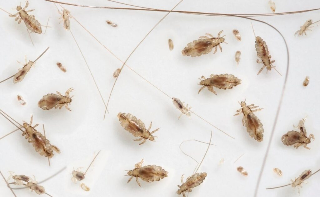 Head lice at various stages of development from egg to imago ( adult ) on white background